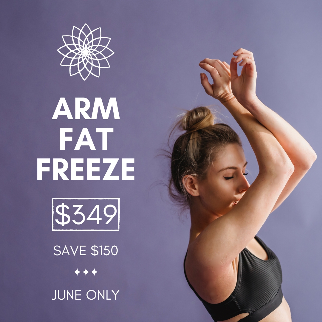 Client receiving non-invasive fat freezing treatment on arm fat at Body Sculpt Perth during June promotion.