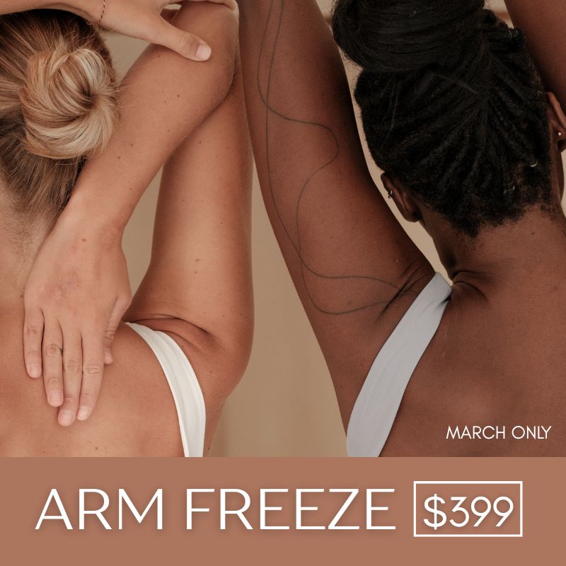 If image is treatment in progress: Arm fat freezing treatment at Body Sculpt Perth – March Special $399 If image is before/after: Arm fat freezing before and after results – Body Sculpt Perth March Special If graphic promo image: March Special Arm Freeze $399 at Body Sculpt Perth Perth WA