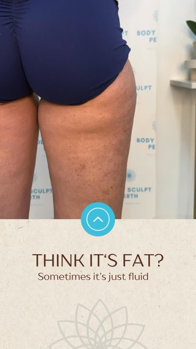 The difference speaks for itself 🩵

Sometimes the changes you can see are the same changes you can feel.

If you’ve been struggling with feeling like your body isn’t reflecting the effort you’re putting in, it may be time to look a little deeper ✨

Ready to start your own transformation?
📍 Book your consultation today.

#bodysculptperth #fluidretention #lymphatichealth #fluidbuildup #confidencestartshere